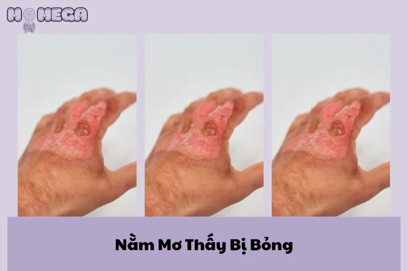 nam-mo-thay-bi-bong-giai-ma-y-nghia-va-diem-bao-quan-trong