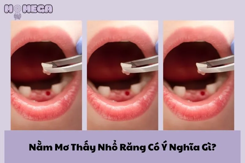 nam-mo-thay-nho-rang-co-y-nghia-gi-giai-ma-va-diem-bao