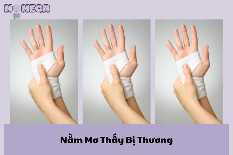 y-nghia-giac-mo-nam-mo-thay-bi-thuong-va-nhung-diem-bao-lien-quan